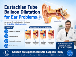 Eustachian Tube Balloon Dilatation procedure for chronic ear problems