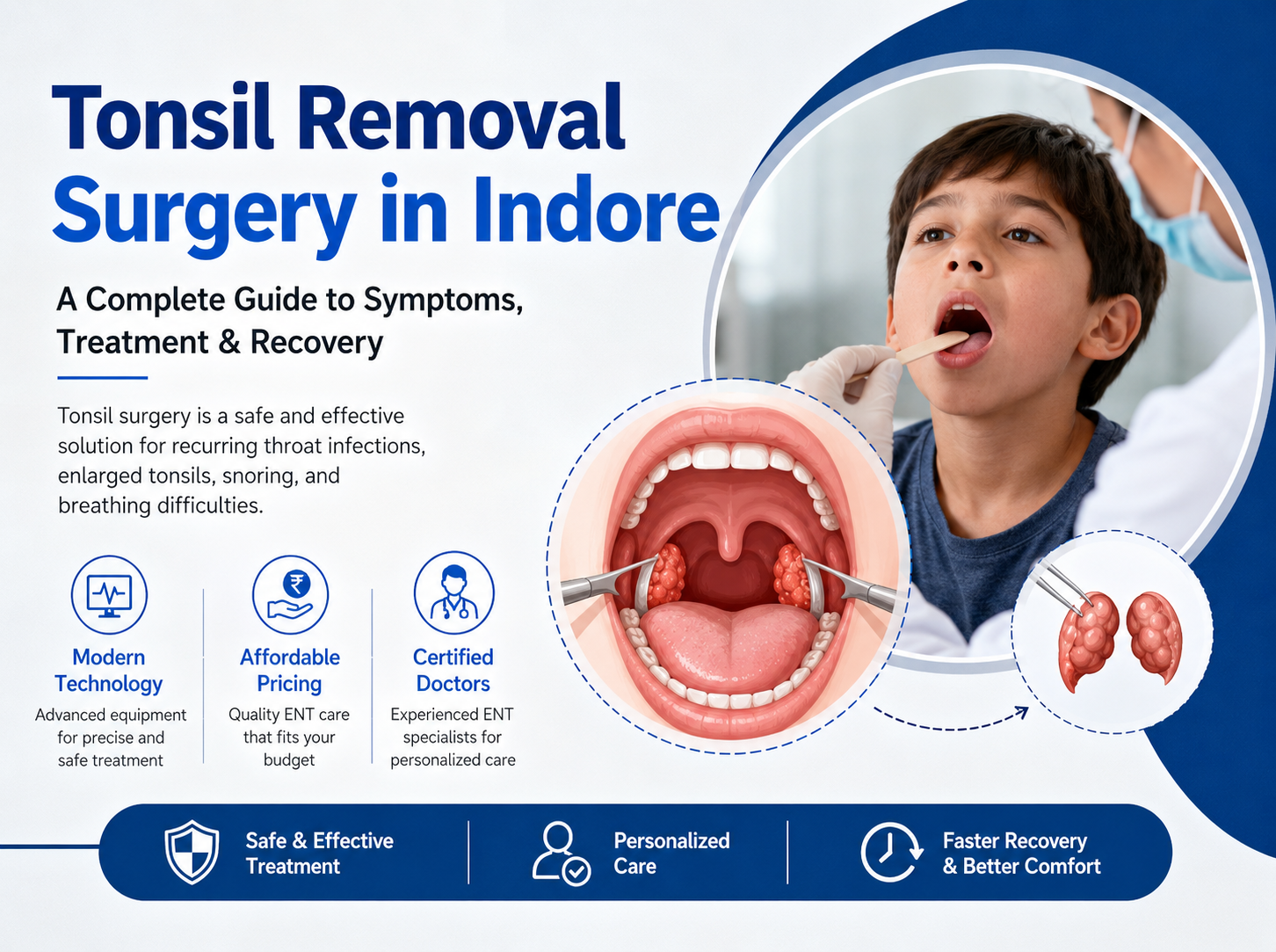 Tonsil Removal Surgery in Indore